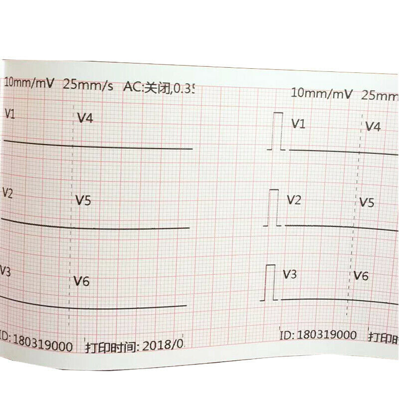 5 Roll High Quality Thermal Printer Paper for ECG/EKG Machine Electrocardiograph